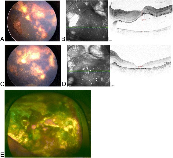 Fig. 2