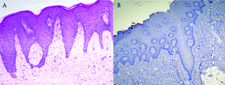 [Table/Fig-3a&b]: