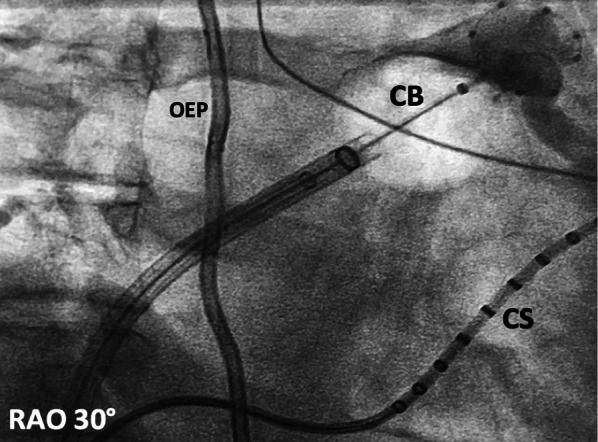 Fig. 2