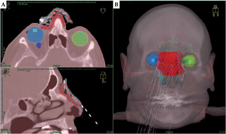 Fig. 2