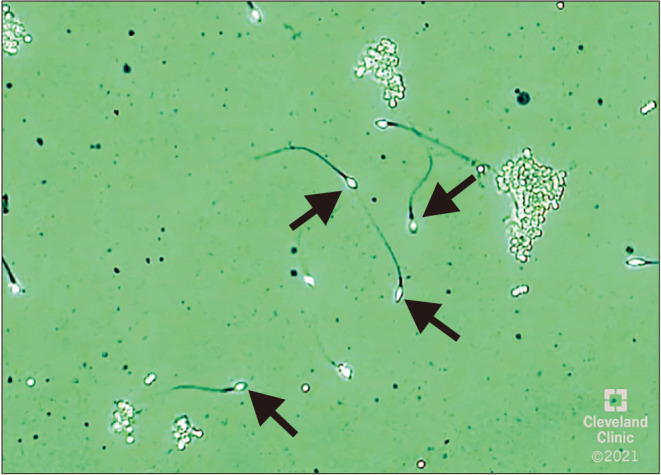 Fig. 5