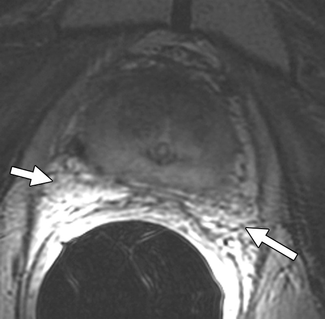 Figure 1b: