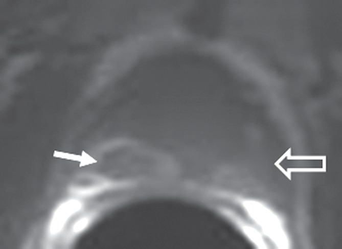 Figure 2a: