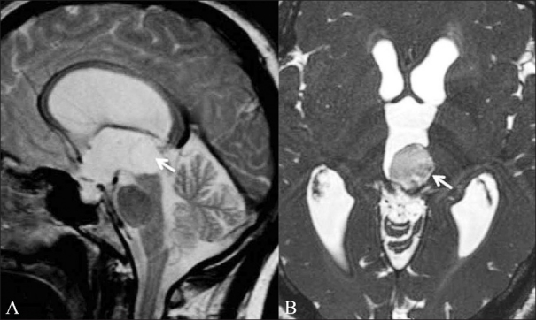 Figure 12 (A,B)