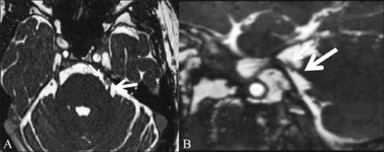 Figure 2 (A,B)