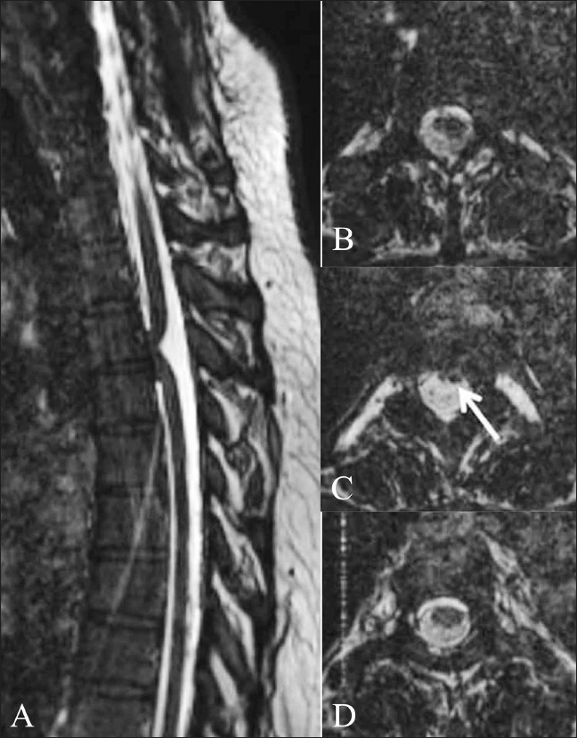 Figure 15 (A-D)