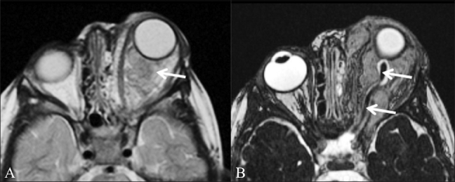 Figure 3 (A,B)