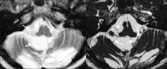 Figure 5 (A,B)