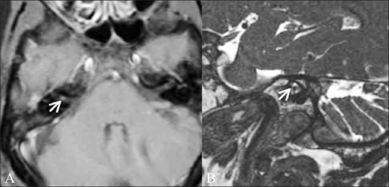 Figure 1 (A,B)