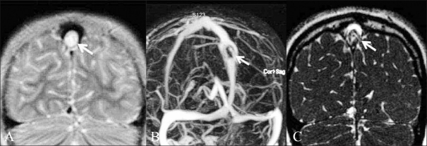 Figure 13 (A-C)