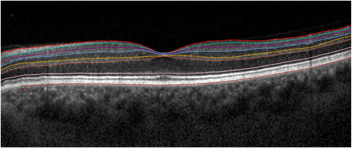 Fig. 1