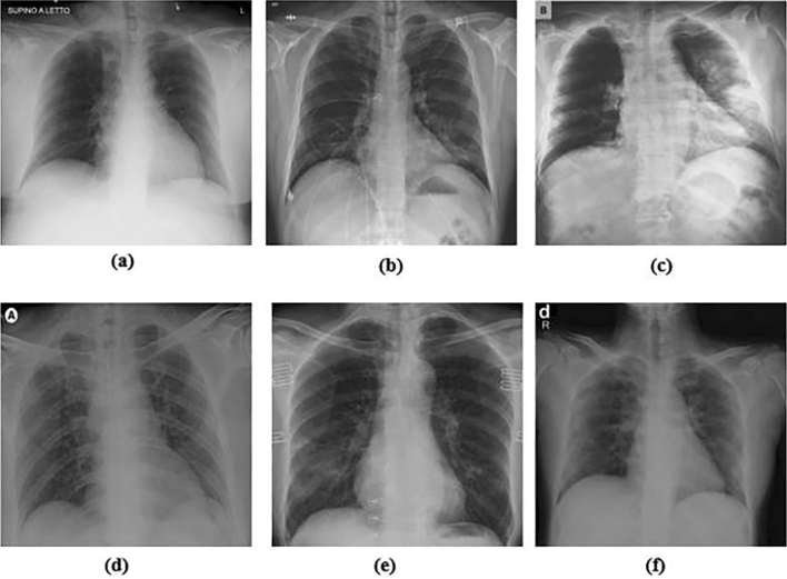 Fig. 10