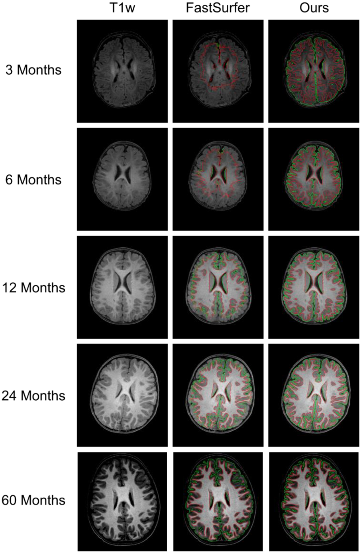 Fig. 10.