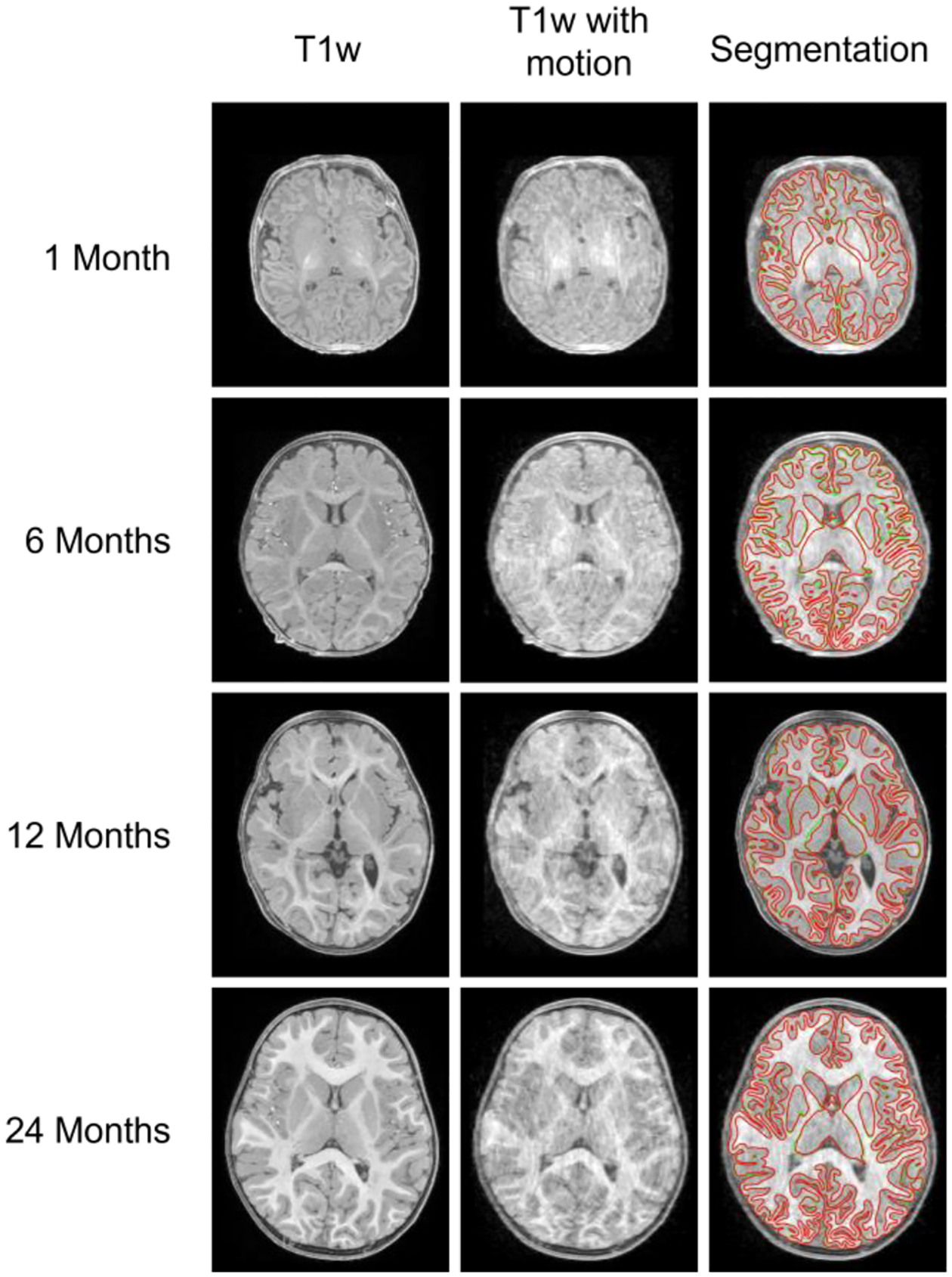 Fig. 15.