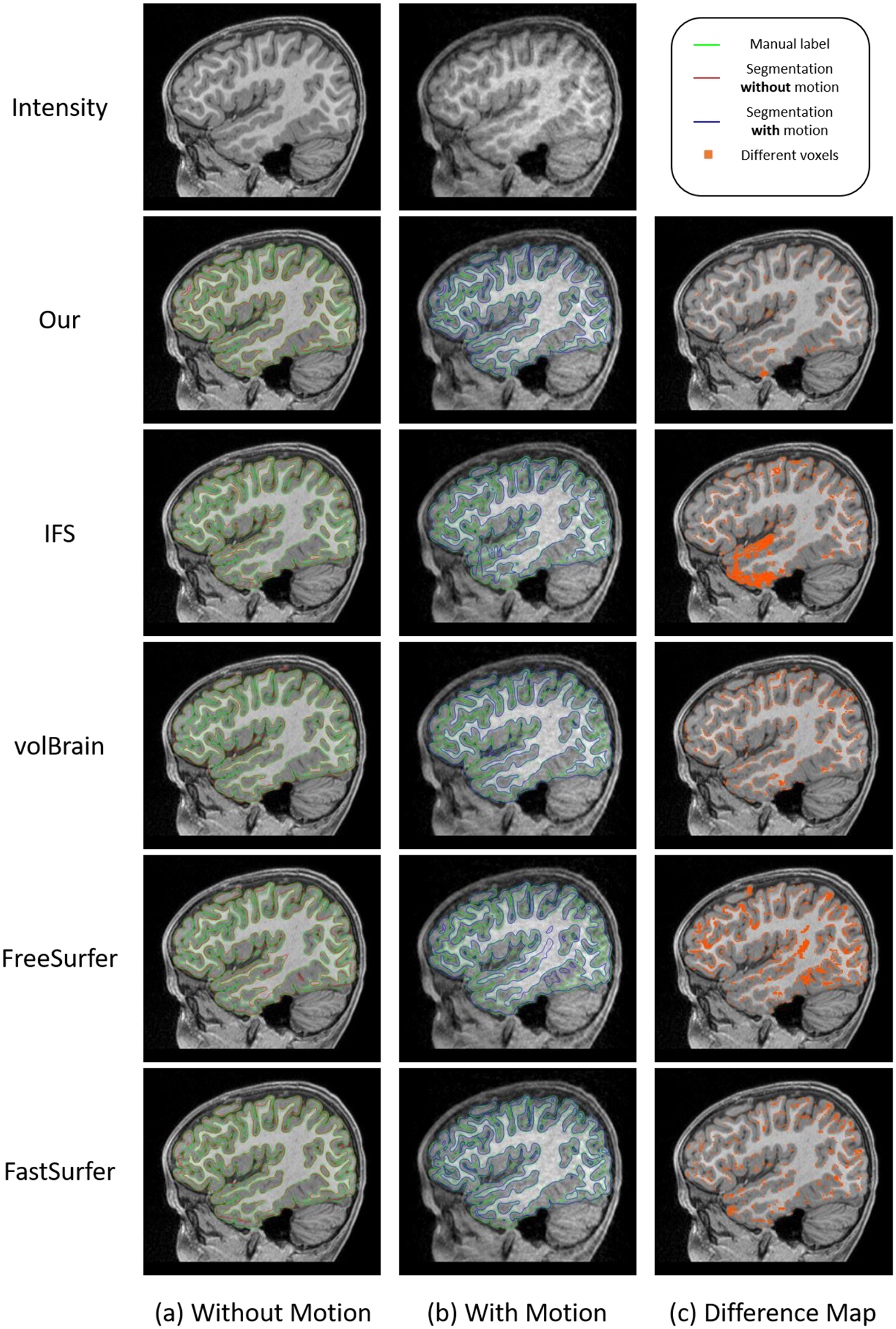 Fig. 13.