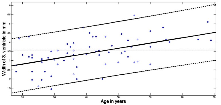 Fig. (3)