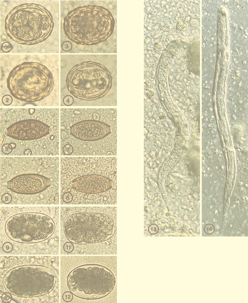 FIG. 1-14