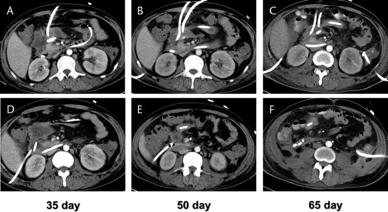 FIGURE 2