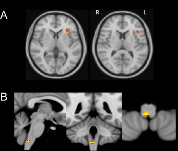 Figure 3—figure supplement 2.