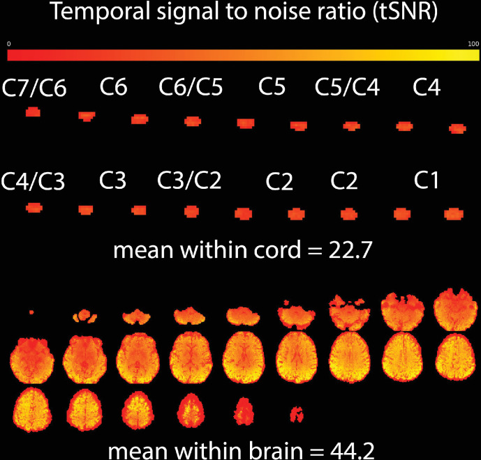 Figure 1—figure supplement 1.