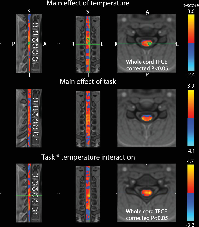 Figure 2—figure supplement 5.