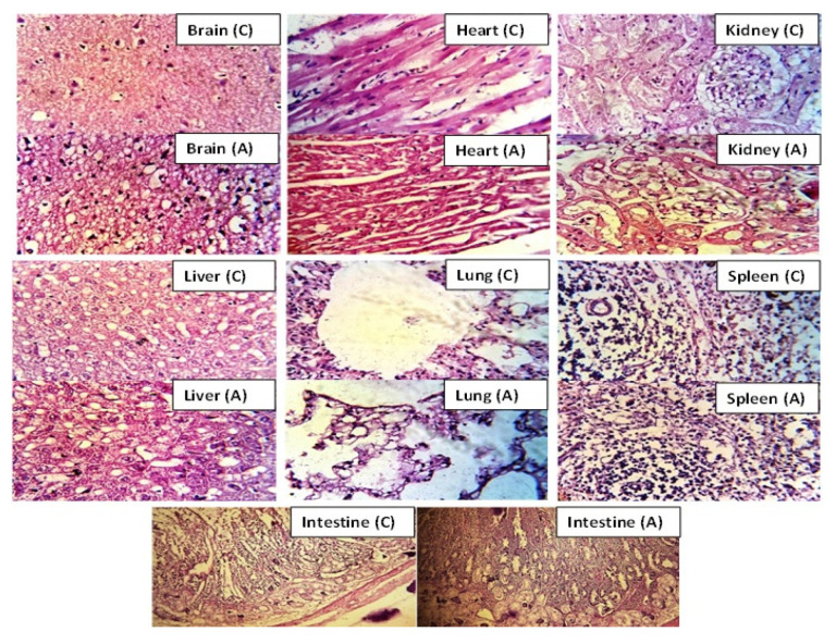 Figure 11