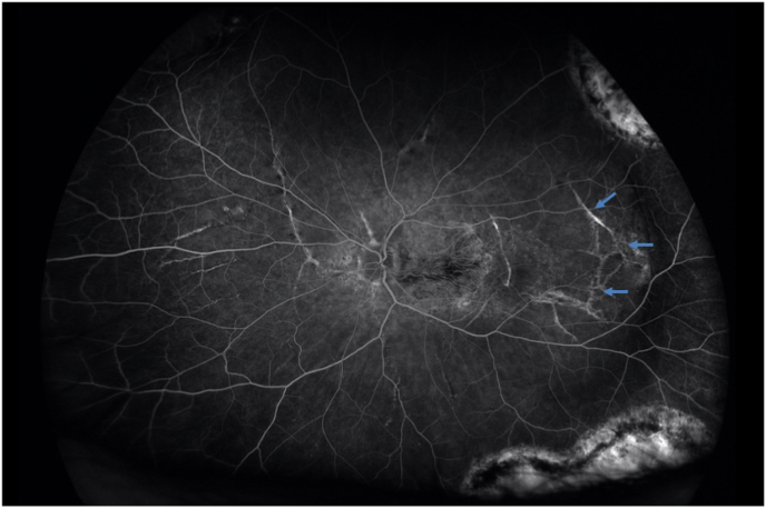 Fig. 5