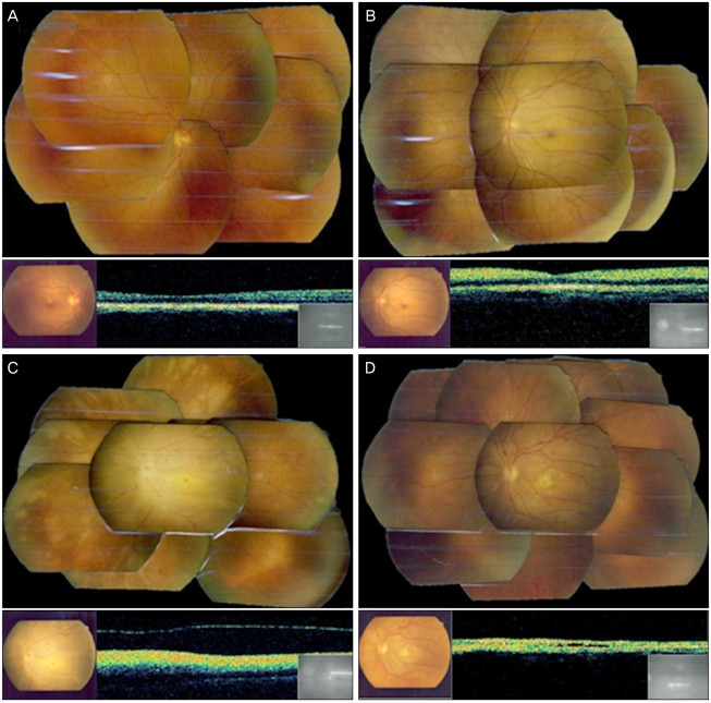 Fig. 2