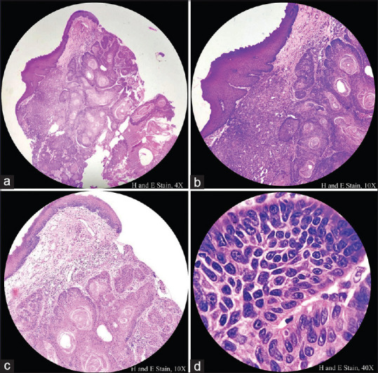 Figure 1(a-d)