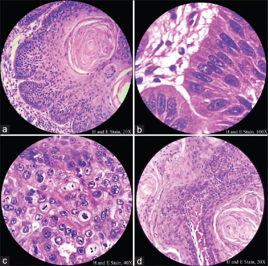 Figure 2(a-d)