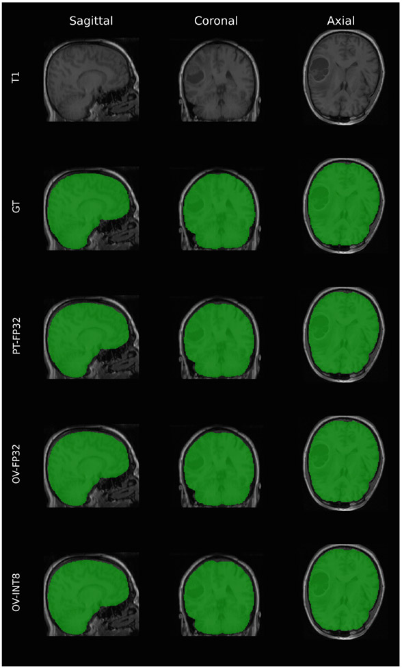 Fig. 4.