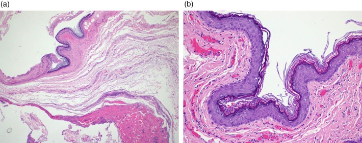 Figure 3 (a&b).