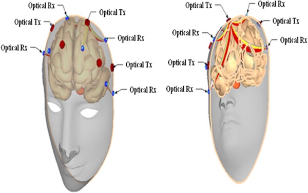 Fig. 1