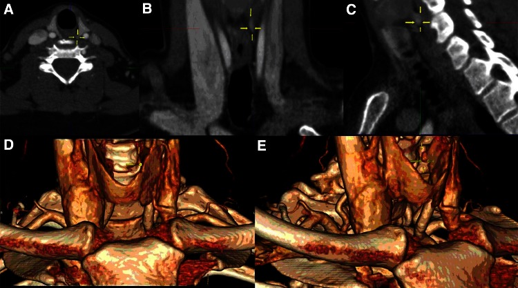 Fig. 1