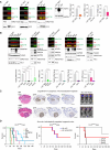 Figure 6. A, Left: acid-extracted histone and protein lysates prepared from ex vivo GS lines derived from the two-hit de novo models (KP, H3.1KP, KF, and KN) were probed for K27M, K27me3, HA, and total H3.3 levels. NSCs derived from the LRL (LRL NSC) were used as controls. Middle: validation of FGFR1 overexpression in ex vivo KF cells; GAPDH was used as a loading control. Right: validation of p53 and NF1 downregulation in ex vivo cells by qRT-PCR. Data are presented as means ± SD from at least n = 3 replicates. ****, P < 0.0001 and ***, P = 0.0003 were calculated using unpaired t test and one-way ANOVA. B, Left: acid-extracted histone and protein lysates prepared from ex vivo GS lines derived from the three- and four-hit de novo models (KPP, KPD, KPAP, KPAD, KPPMPIK, H3.1KACVPIK, KNF, KPF, and KPC) were probed for K27M, K27me3, HA, and total H3.3 levels. LRL NSCs were used as controls. Validation of PDGFRA, PPM1D, PIK3CA, ACVR1, FGFR1, and CCND2 overexpression in ex vivo GS cells; GAPDH and tubulin were used as loading controls. Right: validation of p53, ATRX, and NF1 downregulation in ex vivo GS cells by qRT-PCR. Data are presented as means ± SD from at least n = 3 replicates. ****, P < 0.0001 and ***, P = 0.0003 were calculated using unpaired t test and one-way ANOVA. C, Left: IHC detection of hematoxylin and eosin (H&E), GFP, K27M, and Ki-67 in coronal hindbrain sections from orthotopically engrafted, symptomatic mice. Mice were injected in either the pons (H3K27M) or striatum (H3.3G34R) with 150,000 to 300,000 cells from each cell GS cell line (n = 5 mice per condition). Tumor cells are GFP+. Scale bars, 2 mm. Right: BLI of brainstem tumors in orthotopically engrafted C57BL/6J mice without shaving/depilation using Akaluc imaging. D, Kaplan–Meier curves depicting survival of mice orthotopically injected with GS cells derived from H3.3K27M (left), H3.1K27M (middle), and H3.3G34R (right) models. Note that the following samples are shown twice in A and B: LRL NSC, KF, and KN; these repetitions are indicated with an asterisk. The sole purpose of this repetition is to make it easier for the reader, by collating all the Western blot (WB) data describing the “two-hit” models in A and all the WB data describing the “three-hit or more” models in B.