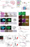 Figure 1. A, Schematic representation of cosegregating mutations in pHGGs and DMGs and their correlation with different anatomic compartments. WT, wild-type. B, Schematic describing in utero electroporation (IUE)–based H3.3G34R-driven brain tumor modeling. Different combinations of piggyBac and CRISPR vectors are delivered into neural stem cells (NSC) in the ganglionic eminences (GE) at E12.5. After birth, mice develop tumors representing distinct pHGG subtypes. Inset: mutation combinations represented in each H3.3G34R model and the acronyms used to refer to them. E12.5, embryonic day 12.5; LOF, loss of function. C, Immunofluorescence and IHC detection of GFP, G34R, Ki-67, and hematoxylin and eosin (H&E) in coronal forebrain sections from tumor-bearing, symptomatic mice. Embryos were electroporated with vectors encoding (i) H3.3G34R, p53LOF, ATRXLOF, PDGFRAWT (GPAP); (ii) H3.3G34R, p53LOF, ATRXLOF, PDGFRAD842V (GPAD); and (iii) H3.3G34R, p53LOF, ATRXLOF, PDGFRAC235Y (GPAC). Tumor cells are GFP+. Higher magnification panels below each low-magnification panel are of the tumor bulk in the ventral forebrain, i.e., striatum, which is what the GE differentiates into in adults. Scale bars, 1 mm in the immunofluorescence panels and 200 μm in the IHC panels. D, Immunofluorescence of tumor tissue in the ventral forebrain, i.e., striatum, to confirm the presence of cointroduced mutations and for colocalization with various markers. Tumor cells are GFP+, G34R+, HA+, PDGFRA+, and ATRX−. They also express higher levels of Ki-67 and Nestin. Scale bars, 50 μm. E, Kaplan–Meier survival curves of IUE, tumor-bearing mice carrying different combinations of mutations. GPAP (n = 15), GPAD (n = 7), and GPAC (n = 17). Statistical comparisons using the log-rank Mantel–Cox tests are described in Supplementary Table S2. F, Left: acid-extracted histone and protein lysates prepared from ex vivo gliomasphere (GS) lines derived from the H3.3G34R-driven de novo models (GPAP, GPAD, and GPAC). GS lines express higher levels of G34R, HA, and PDGFRA than control wild-type NSCs derived from GEs (GE NSC). Total H3.3 levels and GAPDH were used as loading controls. Middle: validation of p53 and ATRX downregulation in ex vivo H3.3G34R GS cells by qRT-PCR. Right: validation of DLX1/2 upregulation in ex vivo H3.3G34R GS cells by qRT-PCR. Data are presented as means ± SD from at least n = 3 replicates. ****, P < 0.0001 and ***, P = 0.0003 were calculated using one-way ANOVA. G, Dose–response curves for mouse GPAP, GPAD, and GPAC cells and normal H3.3WT NSCs (top), and human G34R (GBM002), G34R knockout (KO), and H3.3WT glioma cells (bottom) following treatment with infigratinib for 6 days at the indicated concentrations. Means ± SD are plotted from at least n = 3 replicates. Statistics are summarized in Supplementary Table S7.