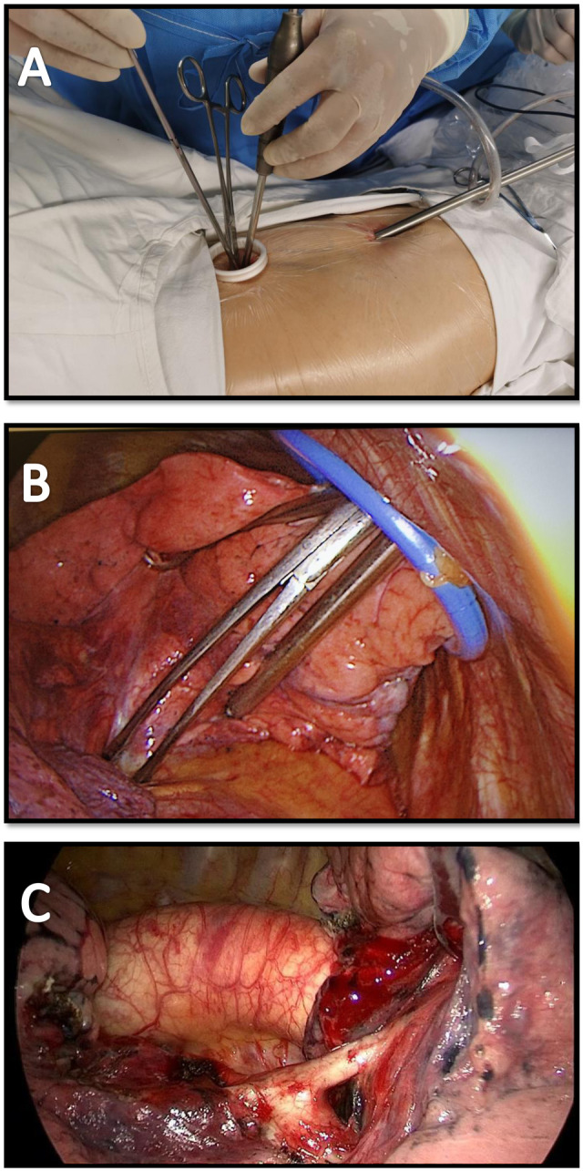 Figure 2: