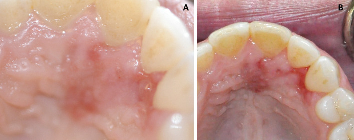 Fig. 1