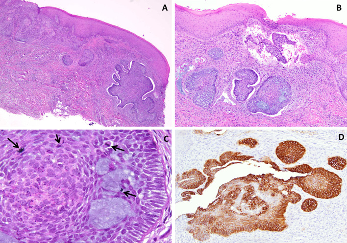 Fig. 2