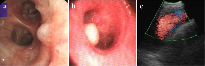 Fig. 3