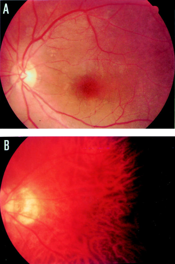 Figure 1  