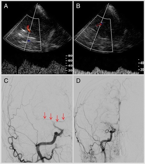 Fig. 4