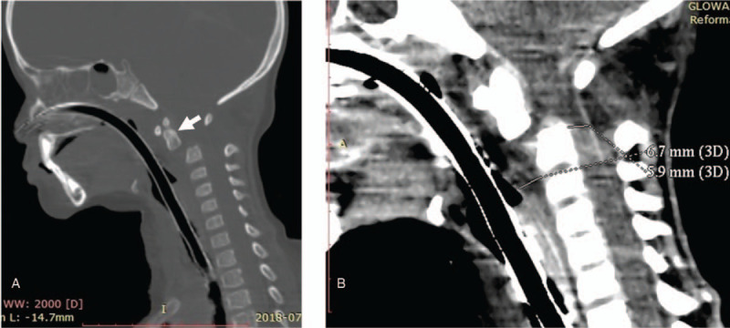 Figure 11