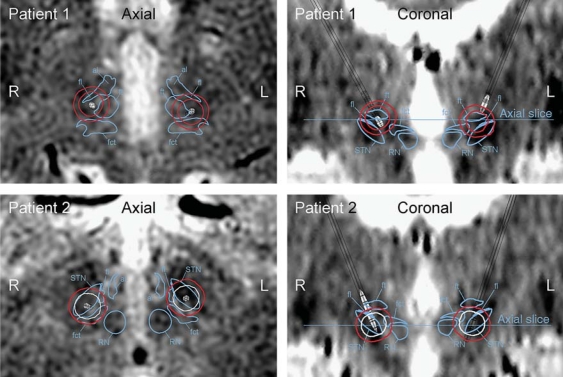 Fig. 3