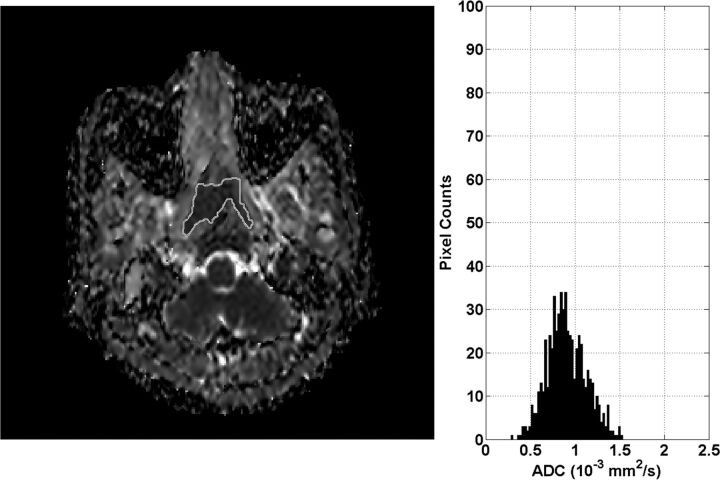 Fig 1.