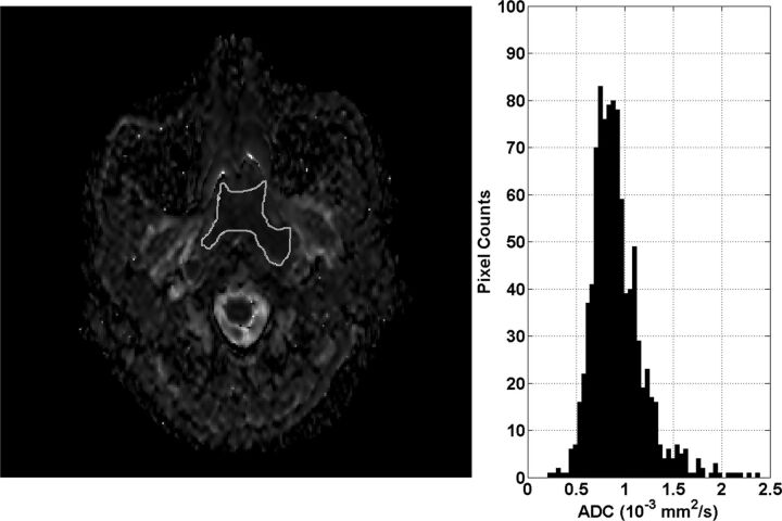 Fig 2.