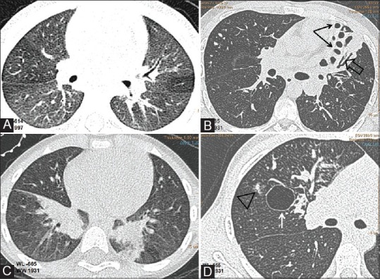 Figure 3(A-D)