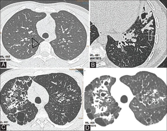 Figure 2(A-D)