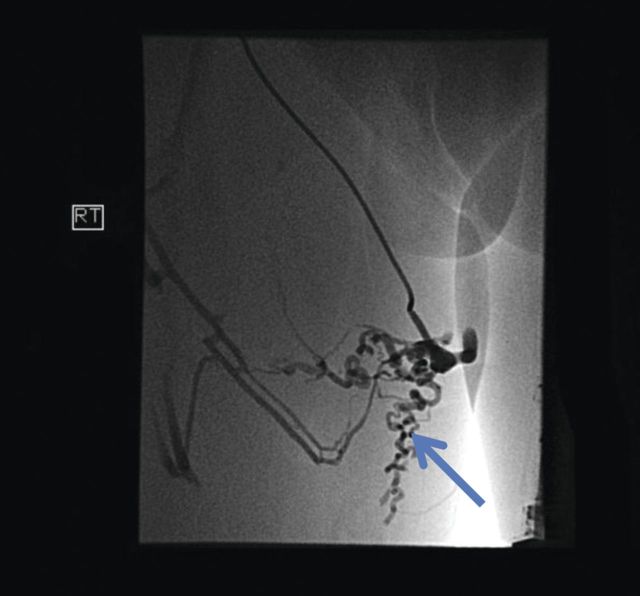 Figure 3: