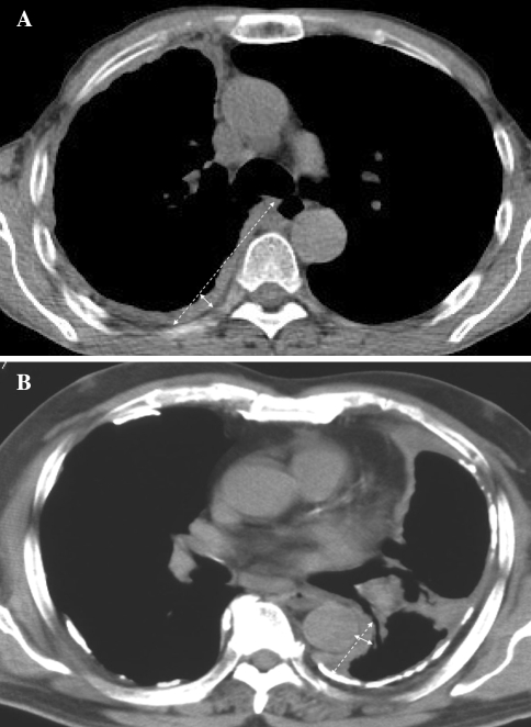 Fig. 2A–B